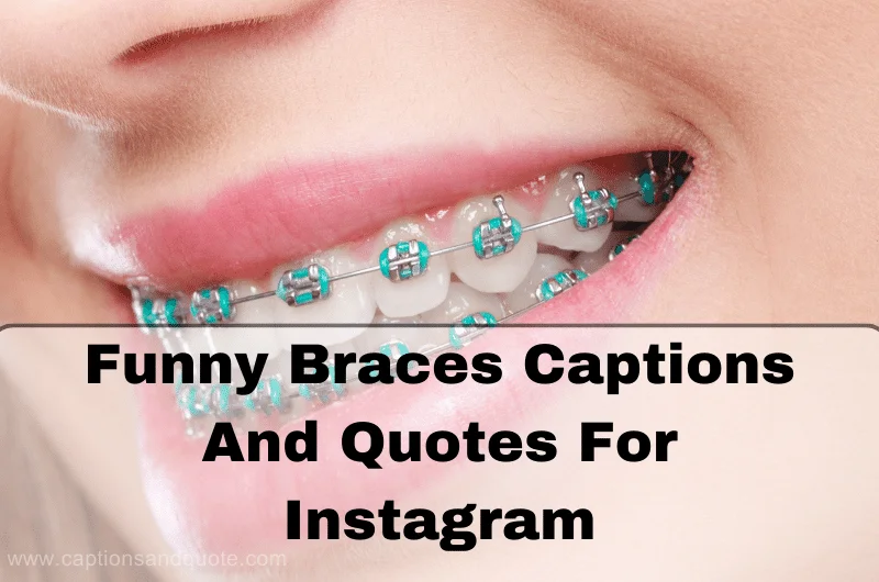 Funny Braces Captions And Quotes for Instagram
